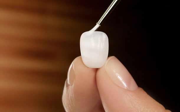 Ljuskice-Tim-Dent-Milicic