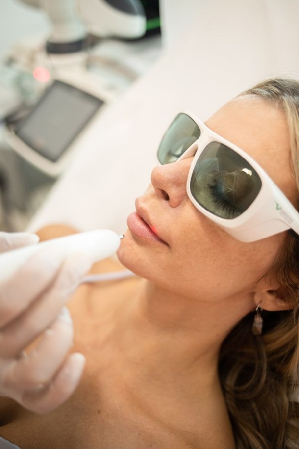 klinika-poliderma-tretmani-1