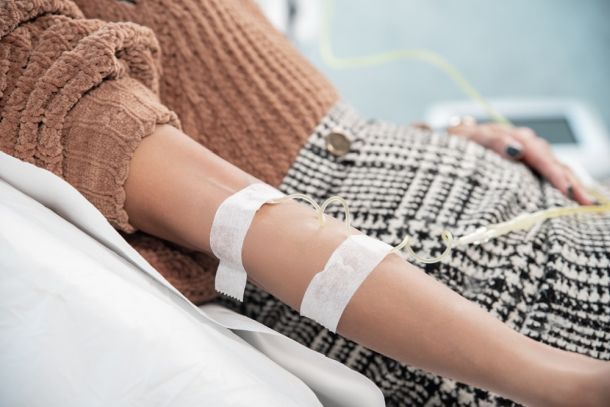 poliklinika-poliderma-tretman-3